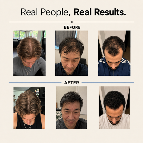 Hair Growth Serum (Roll-On)