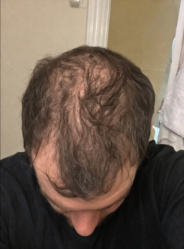 Before - Mourad