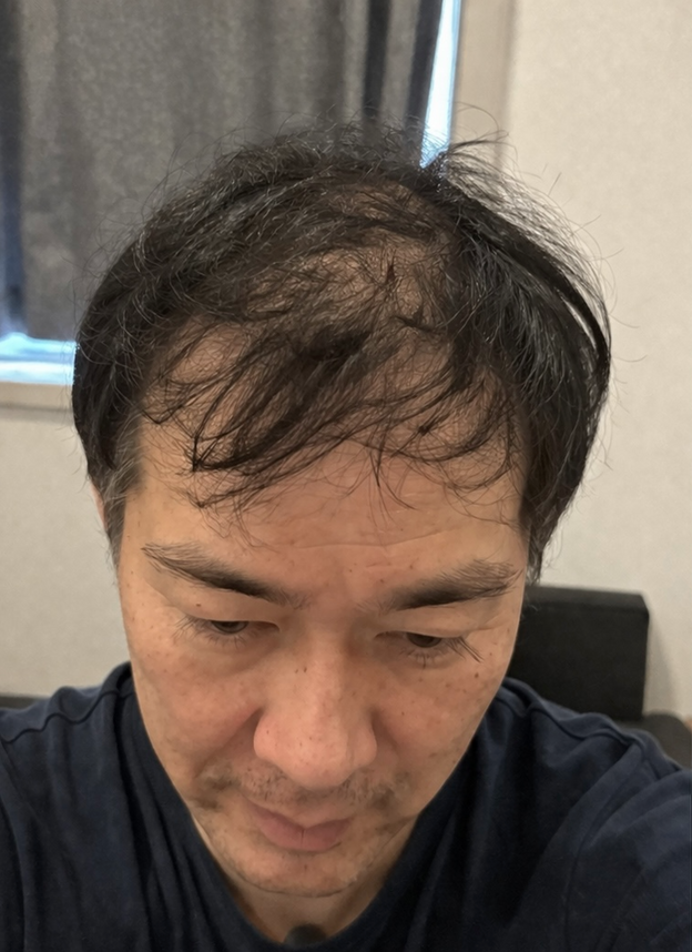Before - Gary